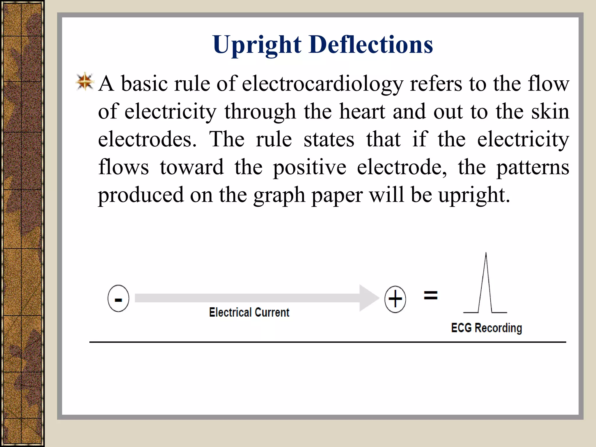 Upright Deflections
A basic rule of electrocardiology refers to the flow
of electricity through the heart and out to the skin
electrodes. The rule states that if the electricity
flows toward the positive electrode, the patterns
produced on the graph paper will be upright.
 