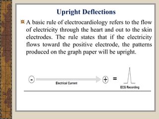 Positive Deflection Ecg for Nurses... | PPT
