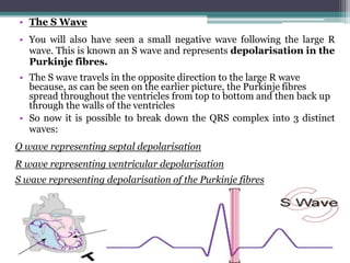 ECG | PPTX