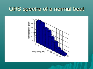 QRS spectra of a normal beatQRS spectra of a normal beat
 
