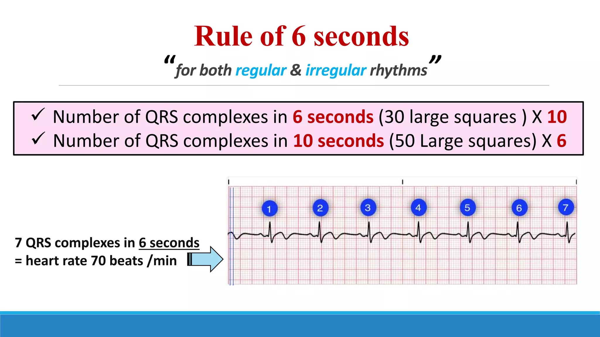 Ecg step by step approach updated pptx