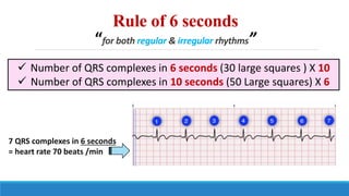 ECG, step by step approach (Updated) | PPTX