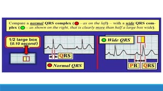 Simple Approach Ecg ECG, step by step approach (Updated) | PPTX