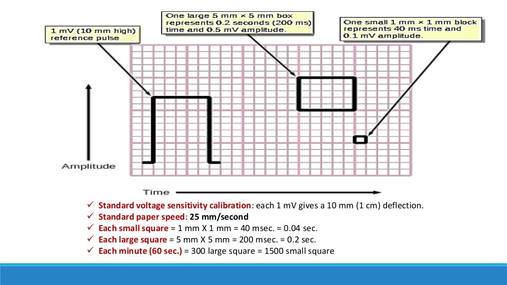 Ecg step by step approach updated 
