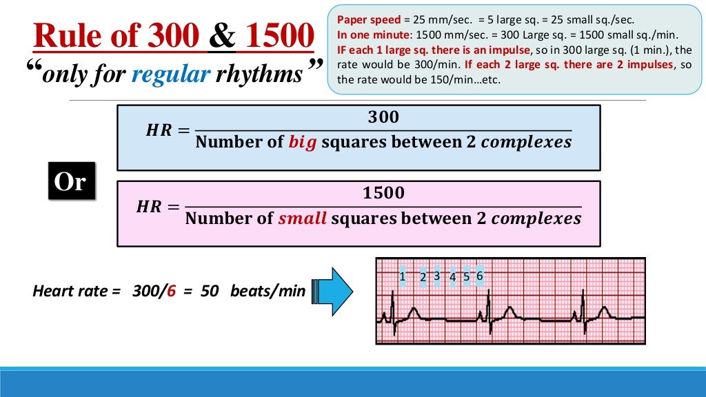 Ecg step by step approach updated 