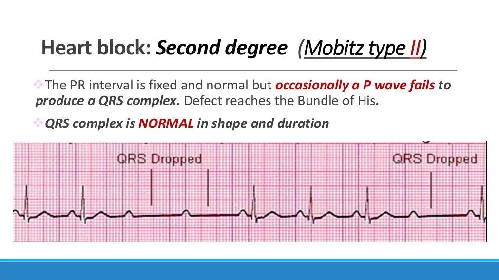 Ecg Step By Step