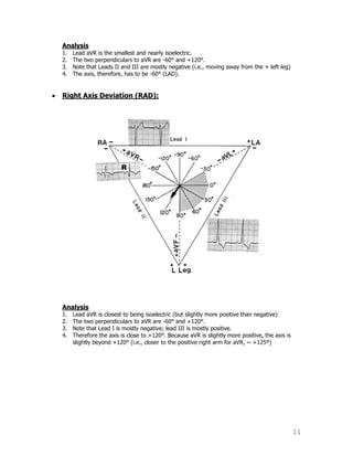 11
Analysis
1. Lead aVR is the smallest and nearly isoelectric.
2. The two perpendiculars to aVR are -60° and +120°.
3. Note that Leads II and III are mostly negative (i.e., moving away from the + left leg)
4. The axis, therefore, has to be -60° (LAD).
Right Axis Deviation (RAD):
Analysis
1. Lead aVR is closest to being isoelectric (but slightly more positive than negative)
2. The two perpendiculars to aVR are -60° and +120°.
3. Note that Lead I is mostly negative; lead III is mostly positive.
4. Therefore the axis is close to +120°. Because aVR is slightly more positive, the axis is
slightly beyond +120° (i.e., closer to the positive right arm for aVR, ~ +125º)
 
