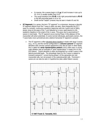 13
In reverse, the s-waves begin in V6 or V5 and increase in size up to
V2. S-V1 is usually smaller than S-V2.
The usual transition from S>R in the right precordial leads to R>S
in the left precordial leads is V3 or V4.
Small normal "septal" q-waves may be seen in leads V5 and V6.
ST Segment: In a sense, the term "ST segment" is a misnomer, because a discrete
ST segment distinct from the T wave is often not seen. More frequently the ST-T
wave is a smooth, continuous waveform beginning with the J-point (end of QRS),
slowly rising to the peak of the T and followed by a more rapid descent to the
isoelectric baseline or the onset of the U wave. This gives rise to asymmetrical T
waves in most leads. The ST segment occurs during Phase 2 (the plateau) of the
myocardial cell action potentials. In some normal individuals, particularly women, the
T wave looks more symmetrical and a distinct horizontal ST segment is present.
The ST segment is often elevated above baseline in leads with large S waves
(e.g., V2-3), and the normal configuration is concave upward. ST segment
elevation with concave upward appearance may also be seen in other leads;
this is called the early repolarization pattern, and is often seen in young,
male athletes (see an example of "early repolarization" in leads V4-6 in the
ECG below). J-point elevation is often accompanied by a small J-wave in the
lateral precordial leads. The physiologic basis for the J-wave is related to
transient outward K+
current during phase I of the epicardial and mid-
myocardial cells, but not present in the subendocardial cells. Prominent J
waves are can also be seen in hypothermia (also called Osborn waves)
 