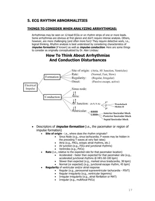 17
5. ECG RHYTHM ABNORMALITIES
THINGS TO CONSIDER WHEN ANALYZING ARRHYTHMIAS:
Arrhythmias may be seen on 12-lead ECGs or on rhythm strips of one or more leads.
Some arrhythmias are obvious at first glance and don't require intense analysis. Others,
however, are more challenging (and often more fun)! They require detective work, i.e.,
logical thinking. Rhythm analysis is best understood by considering characteristics of
impulse formation (if known) as well as impulse conduction. Here are some things
to consider as originally conceptualized by Dr. Alan Lindsay:
Descriptors of impulse formation (i.e., the pacemaker or region of
impulse formation)
Site of origin - i.e., where does the rhythm originate?
Sinus Node (e.g., sinus tachycardia; P waves may be hidden in
the preceding T waves at very fast rates)
Atria (e.g., PACs, ectopic atrial rhythms, etc.)
AV junction (e.g., PJCs and junctional rhythms)
Ventricles (e.g., PVCs)
Rate (i.e., relative to the expected rate for that pacemaker location)
Accelerated - faster than expected for that pacemaker site (e.g.,
accelerated junctional rhythms @ HR‟s 60-100 bpm)
Slower than expected (e.g., marked sinus bradycardia, 38 bpm)
Normal (or expected) (e.g., junctional escape rhythm, 45 bpm)
Regularity of ventricular and/or atrial response
Regular (e.g., paroxysmal supraventricular tachycardia - PSVT)
Regular irregularity (e.g., ventricular bigeminy)
Irregular irregularity (e.g., atrial fibrillation or MAT)
Irregular (e.g., multifocal PVCs)
 