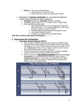 18
Onset (i.e., how does arrhythmia begin?)
Active onset (e.g., PAC or PVC, PSVT)
Passive onset (e.g., ventricular escape beat or rhythm)
Descriptors of impulse conduction (i.e., how does the abnormal
rhythm conduct through the heart chambers?)
Antegrade (forward) vs. retrograde (backward) conduction
Conduction delays or blocks: i.e., 1st
, 2nd
(type I or II), 3rd
degree blocks
Sites of potential conduction delay
Sino-Atrial (SA) block (one can only recognized 2nd
degree SA
block on the ECG; i.e., an unexpected failure of a sinus P-wave
to appear, resulting in a pause in rhythm)
Intra-atrial delay (usually recognized as a widened P wave)
AV conduction delays (common)
IV blocks (e.g., bundle branch or fascicular blocks)
Now let's continue with some real rhythms…………..
I. Supraventricular Arrhythmias
Premature Atrial Complexes (PAC's)
Occur as single or repetitive events and have unifocal or multifocal origins.
The ectopic P wave (often called P') is often hidden in the ST-T wave of the
preceding beat. (Dr. Henry Marriott, master ECG teacher and author, likes to
say: "Cherchez le P" which, in French, means: "Search for the P” (on the T
wave), and it's clearly sexier to search in French!)
The P'R interval can be normal or prolonged if the AV junction is partially
refractory at the time the premature atrial impulse enters it.
PAC's can have one of three different outcomes depending on the degree
of prematurity (i.e., coupling interval from previous P wave), and the
preceding cycle length (i.e., RR interval). This is illustrated in the "ladder"
diagrams where normal sinus beats are followed by three possible PACs
(labled a,b,c,d in the diagram below):
 