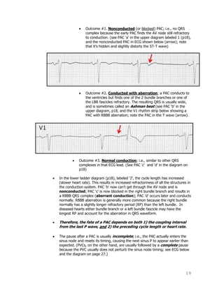 19
Outcome #1. Nonconducted (or blocked) PAC; i.e., no QRS
complex because the early PAC finds the AV node still refractory
to conduction. (see PAC 'a' in the upper diagram labeled 1 (p18),
and the nonconducted PAC in ECG shown below (arrow); note
that it‟s hidden and slightly distorts the ST-T wave)
Outcome #2. Conducted with aberration; a PAC conducts to
the ventricles but finds one of the 2 bundle branches or one of
the LBB fascicles refractory. The resulting QRS is usually wide,
and is sometimes called an Ashman beat (see PAC 'b' in the
upper diagram, p18, and the V1 rhythm strip below showing a
PAC with RBBB aberration; note the PAC in the T wave (arrow).
Outcome #3. Normal conduction; i.e., similar to other QRS
complexes in that ECG lead. (See PAC 'c' and „d‟ in the diagram on
p18)
In the lower ladder diagram (p18), labeled „2‟, the cycle length has increased
(slower heart rate). This results in increased refractoriness of all the structures in
the conduction system. PAC 'b' now can't get through the AV node and is
nonconducted; PAC 'c' is now blocked in the right bundle branch and results in
a RBBB QRS complex (aberrant conduction); PAC 'd' occurs later and conducts
normally. RBBB aberration is generally more common because the right bundle
normally has a slightly longer refractory period (RP) than the left bundle. In
diseased hearts either bundle branch or a left bundle fascicle may have the
longest RP and account for the aberration in QRS waveform.
Therefore, the fate of a PAC depends on both 1) the coupling interval
from the last P wave, and 2) the preceding cycle length or heart rate.
The pause after a PAC is usually incomplete; i.e., the PAC actually enters the
sinus node and resets its timing, causing the next sinus P to appear earlier than
expected. (PVCs, on the other hand, are usually followed by a complete pause
because the PVC usually does not perturb the sinus node timing; see ECG below
and the diagram on page 27.)
 