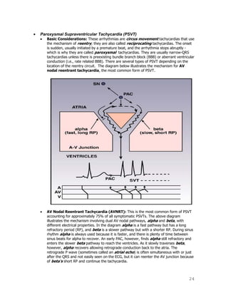 24
Paroxysmal Supraventricular Tachycardia (PSVT)
Basic Considerations: These arrhythmias are circus movement tachycardias that use
the mechanism of reentry; they are also called reciprocating tachycardias. The onset
is sudden, usually initiated by a premature beat, and the arrhythmia stops abruptly -
which is why they are called paroxysmal tachycardias. They are usually narrow-QRS
tachycardias unless there is preexisting bundle branch block (BBB) or aberrant ventricular
conduction (i.e., rate related BBB). There are several types of PSVT depending on the
location of the reentry circuit. The diagram below illustrates the mechanism for AV
nodal reentrant tachycardia, the most common form of PSVT.
AV Nodal Reentrant Tachycardia (AVNRT): This is the most common form of PSVT
accounting for approximately 75% of all symptomatic PSVTs. The above diagram
illustrates the mechanism involving dual AV nodal pathways, alpha and beta, with
different electrical properties. In the diagram alpha is a fast pathway but has a long
refractory period (RP), and beta is a slower pathway but with a shorter RP. During sinus
rhythm alpha is always used because it is faster, and there is plenty of time between
sinus beats for alpha to recover. An early PAC, however, finds alpha still refractory and
enters the slower beta pathway to reach the ventricles. As it slowly traverses beta,
however, alpha recovers allowing retrograde conduction back to the atria. The
retrograde P wave (sometimes called an atrial echo) is often simultaneous with or just
after the QRS and not easily seen on the ECG, but it can reenter the AV junction because
of beta's short RP and continue the tachycardia.
 