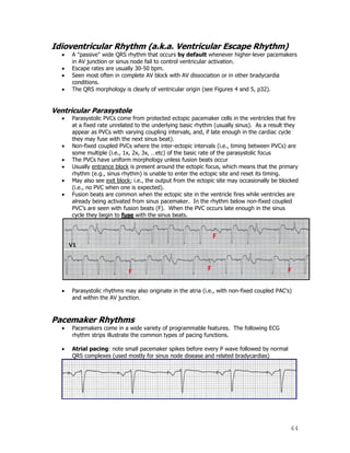 44
Idioventricular Rhythm (a.k.a. Ventricular Escape Rhythm)
A "passive" wide QRS rhythm that occurs by default whenever higher-lever pacemakers
in AV junction or sinus node fail to control ventricular activation.
Escape rates are usually 30-50 bpm.
Seen most often in complete AV block with AV dissociation or in other bradycardia
conditions.
The QRS morphology is clearly of ventricular origin (see Figures 4 and 5, p32).
Ventricular Parasystole
Parasystolic PVCs come from protected ectopic pacemaker cells in the ventricles that fire
at a fixed rate unrelated to the underlying basic rhythm (usually sinus). As a result they
appear as PVCs with varying coupling intervals, and, if late enough in the cardiac cycle
they may fuse with the next sinus beat).
Non-fixed coupled PVCs where the inter-ectopic intervals (i.e., timing between PVCs) are
some multiple (i.e., 1x, 2x, 3x, …etc) of the basic rate of the parasystolic focus
The PVCs have uniform morphology unless fusion beats occur
Usually entrance block is present around the ectopic focus, which means that the primary
rhythm (e.g., sinus rhythm) is unable to enter the ectopic site and reset its timing.
May also see exit block; i.e., the output from the ectopic site may occasionally be blocked
(i.e., no PVC when one is expected).
Fusion beats are common when the ectopic site in the ventricle fires while ventricles are
already being activated from sinus pacemaker. In the rhythm below non-fixed coupled
PVC‟s are seen with fusion beats (F). When the PVC occurs late enough in the sinus
cycle they begin to fuse with the sinus beats.
Parasystolic rhythms may also originate in the atria (i.e., with non-fixed coupled PAC's)
and within the AV junction.
Pacemaker Rhythms
Pacemakers come in a wide variety of programmable features. The following ECG
rhythm strips illustrate the common types of pacing functions.
Atrial pacing: note small pacemaker spikes before every P wave followed by normal
QRS complexes (used mostly for sinus node disease and related bradycardias)
 