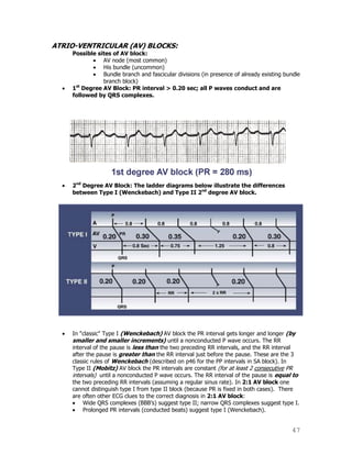 47
ATRIO-VENTRICULAR (AV) BLOCKS:
Possible sites of AV block:
AV node (most common)
His bundle (uncommon)
Bundle branch and fascicular divisions (in presence of already existing bundle
branch block)
1st
Degree AV Block: PR interval > 0.20 sec; all P waves conduct and are
followed by QRS complexes.
2nd
Degree AV Block: The ladder diagrams below illustrate the differences
between Type I (Wenckebach) and Type II 2nd
degree AV block.
In "classic" Type I (Wenckebach) AV block the PR interval gets longer and longer (by
smaller and smaller increments) until a nonconducted P wave occurs. The RR
interval of the pause is less than the two preceding RR intervals, and the RR interval
after the pause is greater than the RR interval just before the pause. These are the 3
classic rules of Wenckebach (described on p46 for the PP intervals in SA block). In
Type II (Mobitz) AV block the PR intervals are constant (for at least 2 consecutive PR
intervals) until a nonconducted P wave occurs. The RR interval of the pause is equal to
the two preceding RR intervals (assuming a regular sinus rate). In 2:1 AV block one
cannot distinguish type I from type II block (because PR is fixed in both cases). There
are often other ECG clues to the correct diagnosis in 2:1 AV block:
Wide QRS complexes (BBB‟s) suggest type II; narrow QRS complexes suggest type I.
Prolonged PR intervals (conducted beats) suggest type I (Wenckebach).
 