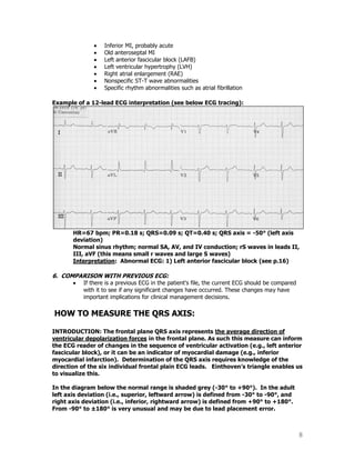 8
Inferior MI, probably acute
Old anteroseptal MI
Left anterior fascicular block (LAFB)
Left ventricular hypertrophy (LVH)
Right atrial enlargement (RAE)
Nonspecific ST-T wave abnormalities
Specific rhythm abnormalities such as atrial fibrillation
Example of a 12-lead ECG interpretation (see below ECG tracing):
HR=67 bpm; PR=0.18 s; QRS=0.09 s; QT=0.40 s; QRS axis = -50° (left axis
deviation)
Normal sinus rhythm; normal SA, AV, and IV conduction; rS waves in leads II,
III, aVF (this means small r waves and large S waves)
Interpretation: Abnormal ECG: 1) Left anterior fascicular block (see p.16)
6. COMPARISON WITH PREVIOUS ECG:
If there is a previous ECG in the patient's file, the current ECG should be compared
with it to see if any significant changes have occurred. These changes may have
important implications for clinical management decisions.
HOW TO MEASURE THE QRS AXIS:
INTRODUCTION: The frontal plane QRS axis represents the average direction of
ventricular depolarization forces in the frontal plane. As such this measure can inform
the ECG reader of changes in the sequence of ventricular activation (e.g., left anterior
fascicular block), or it can be an indicator of myocardial damage (e.g., inferior
myocardial infarction). Determination of the QRS axis requires knowledge of the
direction of the six individual frontal plain ECG leads. Einthoven’s triangle enables us
to visualize this.
In the diagram below the normal range is shaded grey (-30° to +90°). In the adult
left axis deviation (i.e., superior, leftward arrow) is defined from -30° to -90°, and
right axis deviation (i.e., inferior, rightward arrow) is defined from +90° to +180°.
From -90° to ±180° is very unusual and may be due to lead placement error.
 