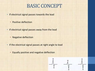 BASIC CONCEPT
• If electrical signal passes towards the lead
• Positive deflection
• If electrical signal passes away from the lead
• Negative deflection
• If the electrical signal passes at right angle to lead
• Equally positive and negative deflection
 