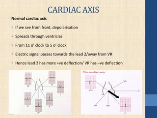 CARDIAC AXIS
Normal cardiac axis
• If we see from front, depolarisation
• Spreads through ventricles
• From 11 o’ clock to 5 o’ clock
• Electric signal passes towards the lead 2/away from VR
• Hence lead 2 has more +ve deflection/ VR has –ve deflection
 