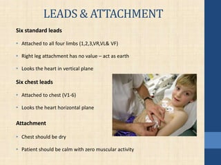 LEADS & ATTACHMENT
Six standard leads
• Attached to all four limbs (1,2,3,VR,VL& VF)
• Right leg attachment has no value – act as earth
• Looks the heart in vertical plane
Six chest leads
• Attached to chest (V1-6)
• Looks the heart horizontal plane
Attachment
• Chest should be dry
• Patient should be calm with zero muscular activity
 
