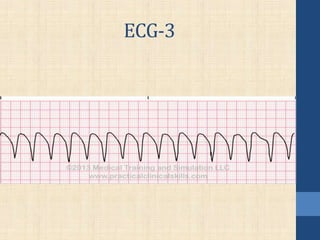 ECG-3
 