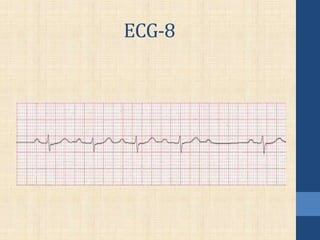 ECG-8
 