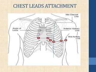 CHEST LEADS ATTACHMENT
 