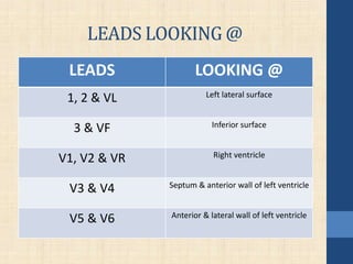 LEADS LOOKING @
LEADS LOOKING @
1, 2 & VL Left lateral surface
3 & VF Inferior surface
V1, V2 & VR Right ventricle
V3 & V4 Septum & anterior wall of left ventricle
V5 & V6 Anterior & lateral wall of left ventricle
 