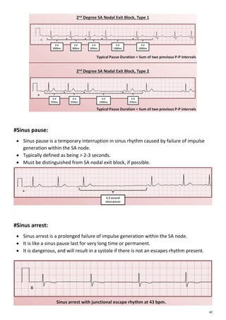 Ecg | PDF