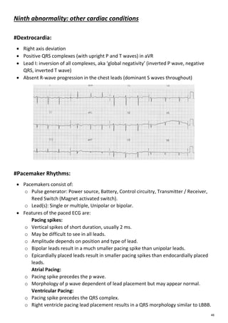 Ecg | PDF