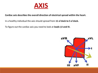 Ecg | PPT