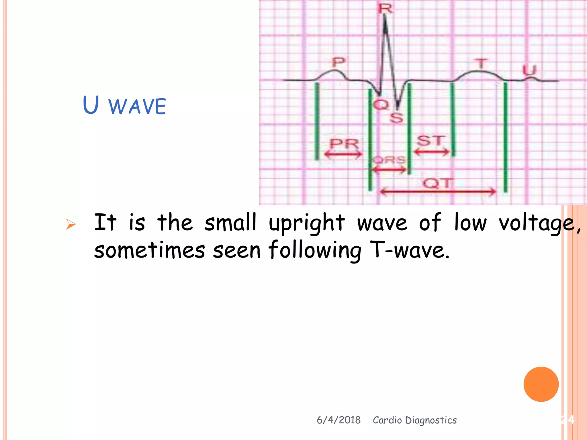 U WAVE
 It is the small upright wave of low voltage,
sometimes seen following T-wave.
6/4/2018 Cardio Diagnostics 24
 