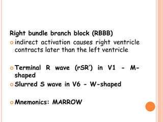 R&b Signaling ECG (easy explanation) | PPTX