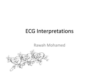 ECG Interpretations
Rawah Mohamed
 