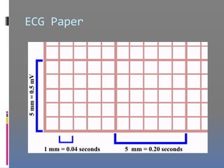 ECG | PPTX