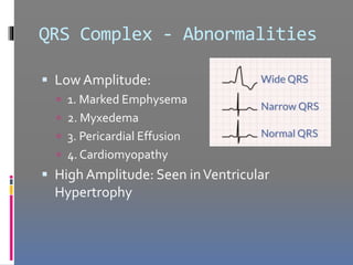 ECG | PPTX