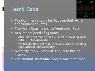 ECG | PPTX