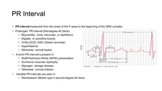 Ecg in children | PPTX