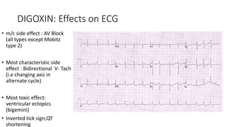 Ecg in children | PPTX