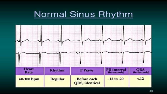 Ecg in children