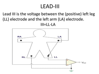 LEAD-III
Lead III is the voltage between the (positive) left leg
(LL) electrode and the left arm (LA) electrode.
III=LL-LA
 