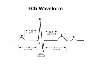 ECG Waveform
 