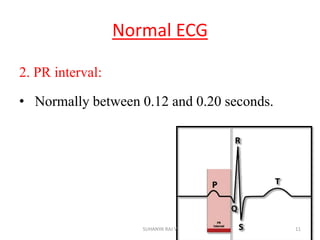 Normal ECG
2. PR interval:
• Normally between 0.12 and 0.20 seconds.
11SUHANYA RAJ V
 