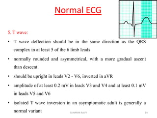 Normal ECG
5. T wave:
• T wave deflection should be in the same direction as the QRS
complex in at least 5 of the 6 limb leads
• normally rounded and asymmetrical, with a more gradual ascent
than descent
• should be upright in leads V2 - V6, inverted in aVR
• amplitude of at least 0.2 mV in leads V3 and V4 and at least 0.1 mV
in leads V5 and V6
• isolated T wave inversion in an asymptomatic adult is generally a
normal variant 14SUHANYA RAJ V
 