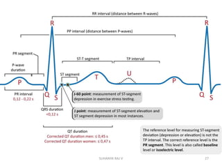 Step-by-Step ECG Interpretation
• Rate
• Rhythm
• Cardiac axis
• P- wave
• PR-interval
• QRS complex
• ST segment
• QT interval(include T and U wave)
• Other ECG signs
27SUHANYA RAJ V
 