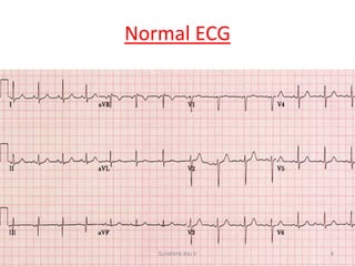 Normal ECG
8SUHANYA RAJ V
 