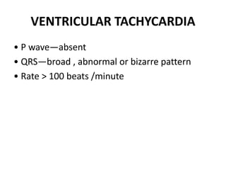 Broad bizzare QRS complex
Absent P wave
Heart rate >100b/min
 