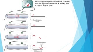 Recording the depolarization wave (A and B)
and the repolarization wave (C and D) from
a cardiac muscle fiber.
 