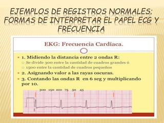 EJEMPLOS DE REGISTROS NORMALES;
FORMAS DE INTERPRETAR EL PAPEL ECG Y
FRECUENCIA
 