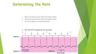 ECG | PPTX