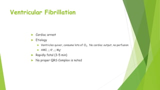 Ventricular Fibrillation
 Cardiac arrest
 Etiology
 Ventricles quiver, consume lots of O2, No cardiac output, no perfusion
 AMI, ↓ K+, ↓ Mg+
 Rapidly fatal (3-5 min)
 No proper QRS Complex is noted
 