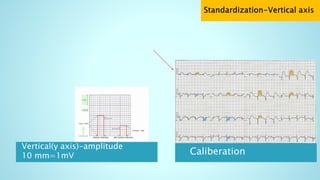 Vertical(y axis)-amplitude
10 mm=1mV Caliberation
 